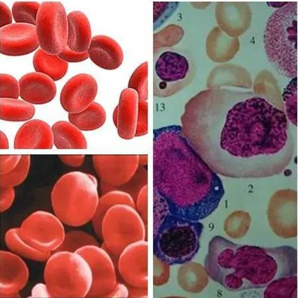 Long term use of Pyrimethamine can interfere with folate utilization in the body, leading to megaloblastic anemia
